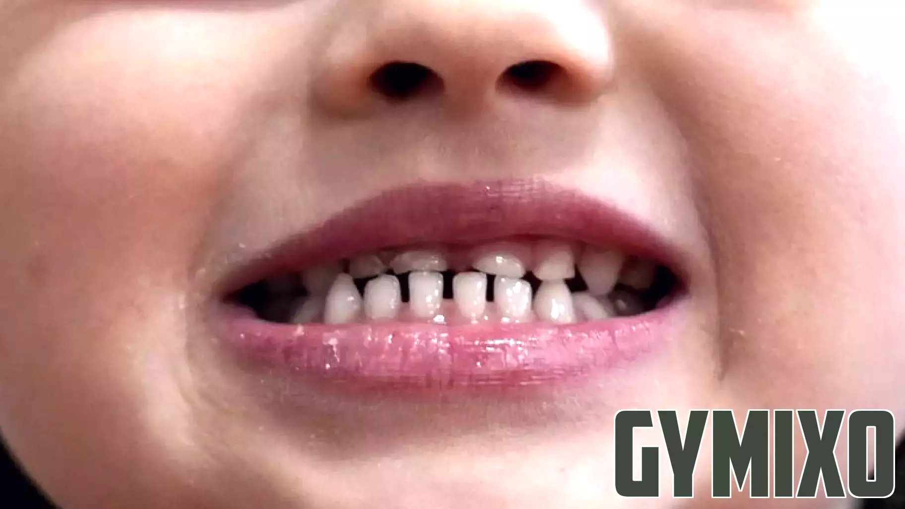 FDA Takes Steps to Limit Prescription Fluoride Supplements