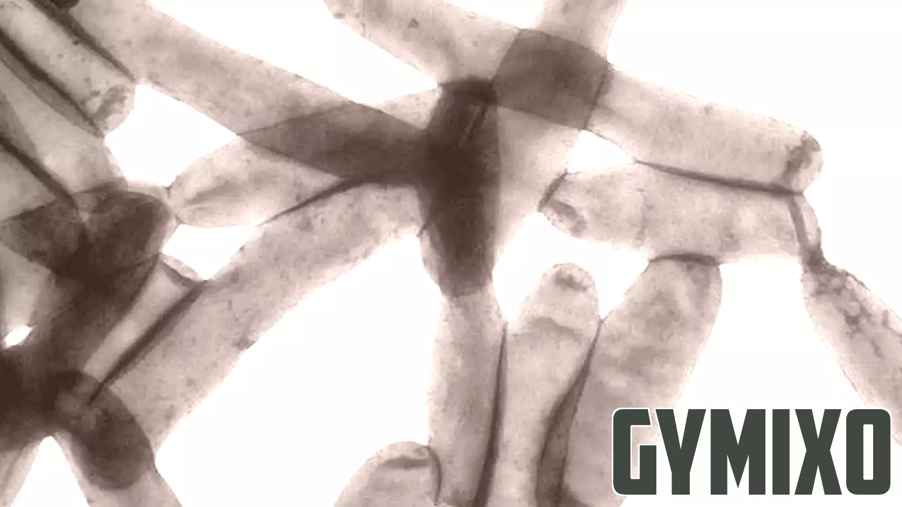 Legionella detected in North Oakland Health Center and the Resource and Crisis Center in Oakland County