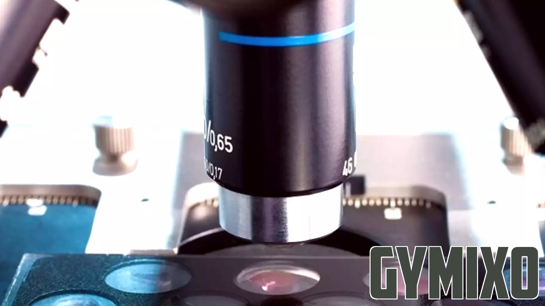 Motion Analysis Reveals Distinction Between Cancerous and Healthy Cells
