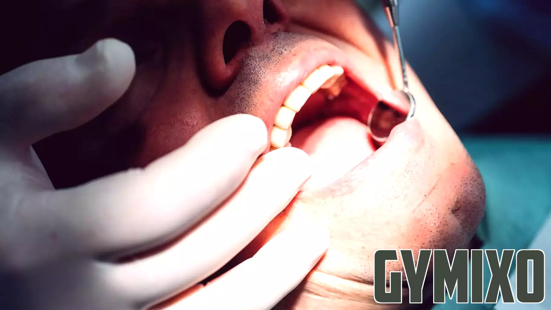 The bacteria behind gum disease may also harm your heart valves, early research suggests