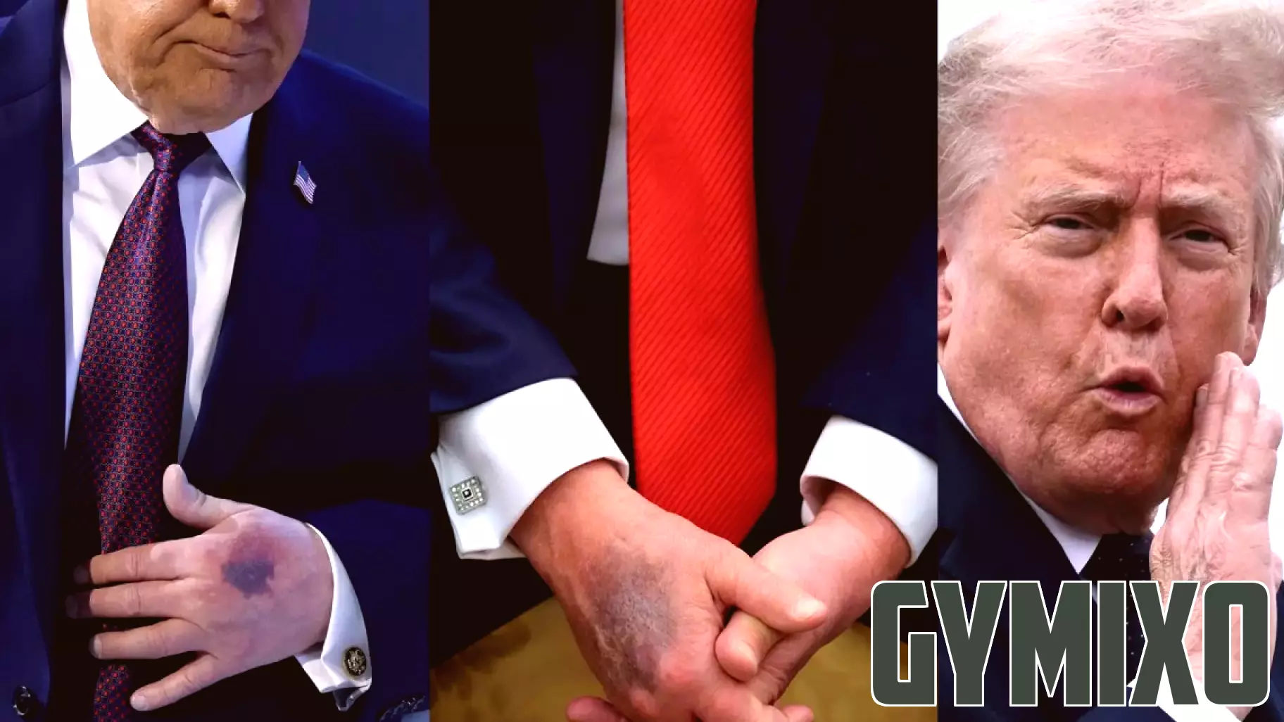 Why aren’t Democrats talking about Trump’s health?