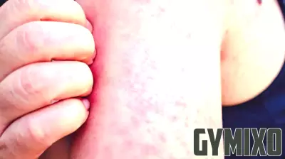 First Measles Case of 2025 Reported in Missouri