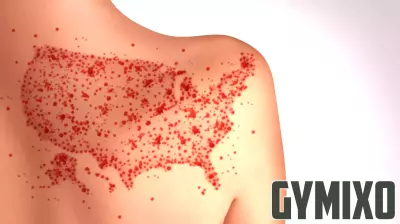 First Measles Case of the Year Reported in Shelby County