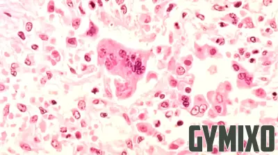Illinois Unveils Measles Simulation Dashboard to Combat Outbreak Risks