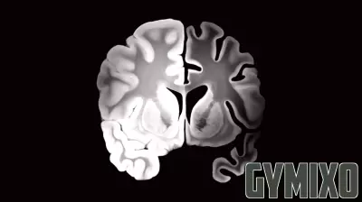 The Overlooked Crisis: Why ‘Brain Health’ Conversations Exclude Mental Illness